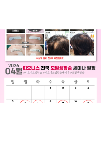 피오니스, 4월 전국 순회 ‘모발생장술 세미나’ 본격 진행